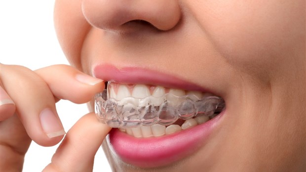 L’orthodontie en 5 questions