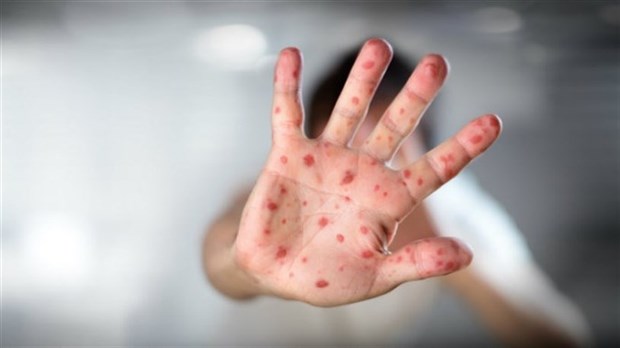 Vaccin de rappel préscolaire pour les enfants qui entrent à la maternelle